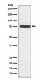 Mitogen-Activated Protein Kinase Kinase Kinase 7 antibody, M01458, Boster Biological Technology, Western Blot image 