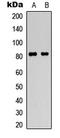 Heat Shock Transcription Factor 1 antibody, LS-C359023, Lifespan Biosciences, Western Blot image 