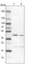 Ring Finger Protein 126 antibody, PA5-60215, Invitrogen Antibodies, Western Blot image 