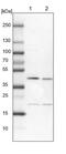 Ring Finger Protein 126 antibody, PA5-60215, Invitrogen Antibodies, Western Blot image 