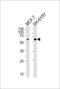 Zinc Finger And BTB Domain Containing 22 antibody, LS-C157388, Lifespan Biosciences, Western Blot image 