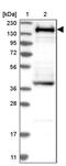 SWI/SNF Related, Matrix Associated, Actin Dependent Regulator Of Chromatin Subfamily C Member 1 antibody, PA5-55058, Invitrogen Antibodies, Western Blot image 