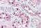 Isocitrate Dehydrogenase (NAD(+)) 3 Gamma antibody, orb22492, Biorbyt, Immunohistochemistry paraffin image 