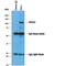 Polycomb protein SUZ12 antibody, AF4184, R&D Systems, Western Blot image 