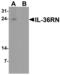 Interleukin 36 Receptor Antagonist antibody, PA5-72779, Invitrogen Antibodies, Western Blot image 