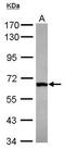 DEAD-Box Helicase 28 antibody, GTX116603, GeneTex, Western Blot image 