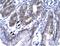 SNF8 Subunit Of ESCRT-II antibody, PA5-40389, Invitrogen Antibodies, Immunohistochemistry paraffin image 