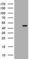Gamma-Butyrobetaine Hydroxylase 1 antibody, LS-C337966, Lifespan Biosciences, Western Blot image 