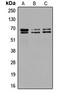 Glutamate Decarboxylase 1 antibody, LS-C352222, Lifespan Biosciences, Western Blot image 