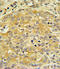 Apolipoprotein L1 antibody, LS-C100542, Lifespan Biosciences, Immunohistochemistry paraffin image 