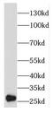 EMG1 N1-Specific Pseudouridine Methyltransferase antibody, FNab02754, FineTest, Western Blot image 