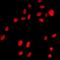 Zinc Finger E-Box Binding Homeobox 1 antibody, LS-C667943, Lifespan Biosciences, Immunofluorescence image 