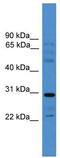 Gap Junction Protein Gamma 3 antibody, TA341681, Origene, Western Blot image 