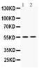 VRK Serine/Threonine Kinase 1 antibody, PA5-80222, Invitrogen Antibodies, Western Blot image 