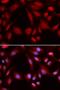 Proteasome 26S Subunit, Non-ATPase 7 antibody, LS-C334006, Lifespan Biosciences, Immunofluorescence image 