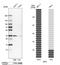 N-Methylpurine DNA Glycosylase antibody, HPA006531, Atlas Antibodies, Western Blot image 