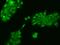 Zinc Finger Protein 543 antibody, 206345-T02, Sino Biological, Immunohistochemistry paraffin image 