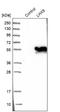 LIM/homeobox protein Lhx9 antibody, NBP1-86114, Novus Biologicals, Western Blot image 