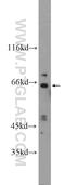 Kelch Like Family Member 28 antibody, 25224-1-AP, Proteintech Group, Western Blot image 