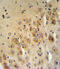 Serpin Family B Member 2 antibody, LS-C99290, Lifespan Biosciences, Immunohistochemistry paraffin image 