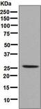 Homeobox B9 antibody, ab133701, Abcam, Western Blot image 