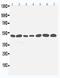 Serine/Threonine Kinase 11 antibody, PA1355, Boster Biological Technology, Western Blot image 