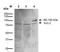 Potassium Voltage-Gated Channel Subfamily C Member 2 antibody, orb376704, Biorbyt, Western Blot image 