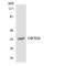 Olfactory Receptor Family 5 Subfamily H Member 6 (Gene/Pseudogene) antibody, LS-C200400, Lifespan Biosciences, Western Blot image 