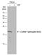 Cofilin 1 antibody, GTX133865, GeneTex, Western Blot image 