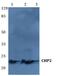 Calcineurin Like EF-Hand Protein 2 antibody, PA5-75494, Invitrogen Antibodies, Western Blot image 