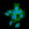 Transforming Growth Factor Beta Receptor 2 antibody, M00759-2, Boster Biological Technology, Immunofluorescence image 