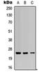 RAB5C, Member RAS Oncogene Family antibody, orb315812, Biorbyt, Western Blot image 