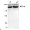 Chromodomain Helicase DNA Binding Protein 3 antibody, LS-C813050, Lifespan Biosciences, Western Blot image 