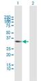 RCC1 And BTB Domain Containing Protein 1 antibody, H00055213-B01P, Novus Biologicals, Western Blot image 