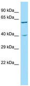 Synaptotagmin 10 antibody, TA331512, Origene, Western Blot image 