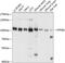 Karyopherin Subunit Beta 1 antibody, GTX66534, GeneTex, Western Blot image 