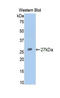Cartilage Oligomeric Matrix Protein antibody, LS-C293187, Lifespan Biosciences, Western Blot image 