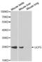 Mitochondrial uncoupling protein 3 antibody, abx001290, Abbexa, Western Blot image 