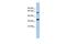 Calcium Homeostasis Modulator 3 antibody, GTX45114, GeneTex, Western Blot image 