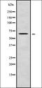 Gamma-Aminobutyric Acid Type A Receptor Epsilon Subunit antibody, orb338320, Biorbyt, Western Blot image 