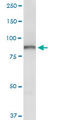 Oxysterol-binding protein 1 antibody, LS-C197827, Lifespan Biosciences, Western Blot image 