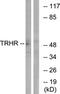 Thyrotropin Releasing Hormone Receptor antibody, LS-C121024, Lifespan Biosciences, Western Blot image 