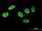 Cyclin Dependent Kinase 12 antibody, H00051755-M04, Novus Biologicals, Immunocytochemistry image 