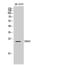 Cyclin Dependent Kinase Inhibitor 3 antibody, A05157, Boster Biological Technology, Western Blot image 