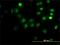 Chromosome Segregation 1 Like antibody, H00001434-M01, Novus Biologicals, Immunocytochemistry image 