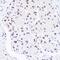 SWI/SNF Related, Matrix Associated, Actin Dependent Regulator Of Chromatin, Subfamily A, Member 4 antibody, GTX32478, GeneTex, Immunocytochemistry image 