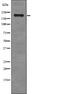 ALK Receptor Tyrosine Kinase antibody, PA5-64801, Invitrogen Antibodies, Western Blot image 