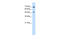 RAD23 Homolog A, Nucleotide Excision Repair Protein antibody, 29-716, ProSci, Enzyme Linked Immunosorbent Assay image 