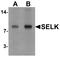 Selenoprotein K antibody, LS-C153629, Lifespan Biosciences, Western Blot image 