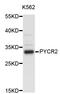 Pyrroline-5-Carboxylate Reductase 2 antibody, STJ25246, St John